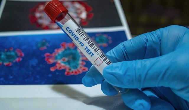 Las pruebas moleculares (PCR), indican si hay presencia del material genético del virus o no. Foto: Ilustrativa / Pixabay