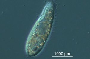 El organismo unicelular Philaster apodigitiformis estaría acabando con los erizos Diadema. Foto: EFE